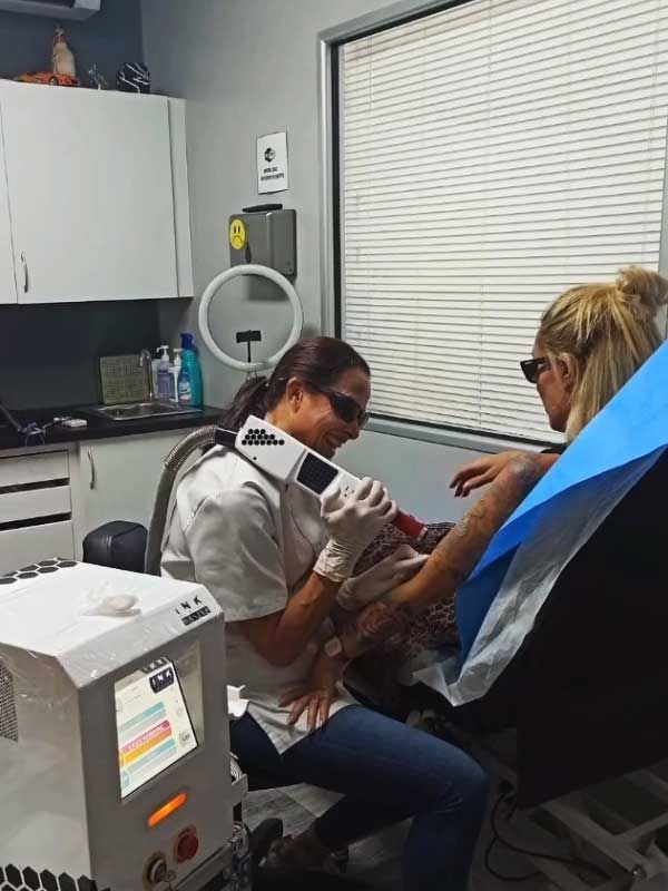 Borrar tatuaje Nova Tinta Tatto